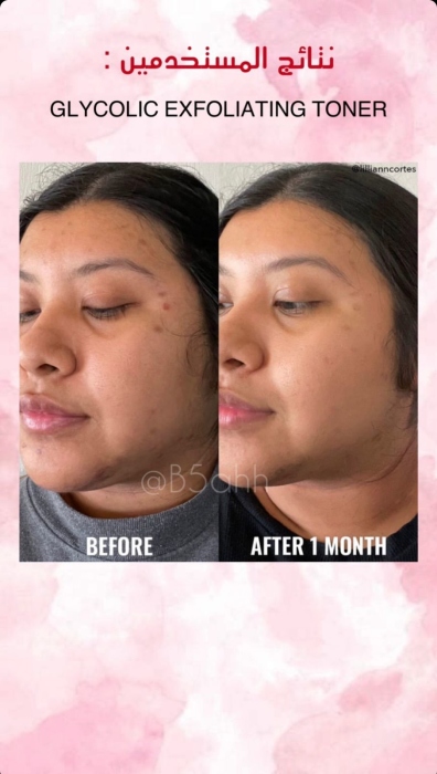 Good molecules, GLYCOLIC EXFOLIATING TONER  